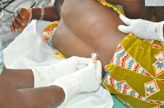 Two SHS students confirmed dead in Bawku with Cerebrospinal Meningitis
