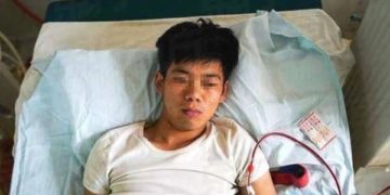 Chinese man disabled for life after selling kidney to buy iPhone