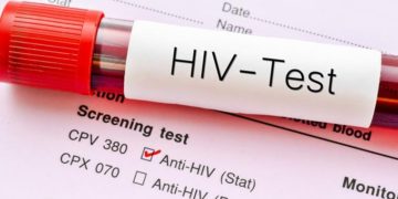 45% Ghanaians don’t know their HIV Status