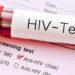 45% Ghanaians don’t know their HIV Status