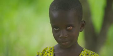 Vodafone Healthline Saves 5-year-old with Eye tumour