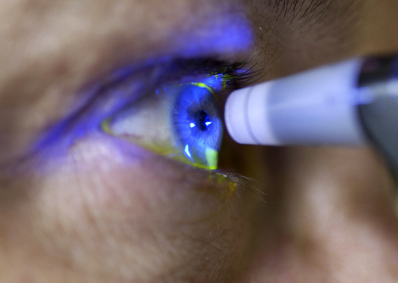 Glaucoma accounts for 20% of blind cases in Ghana – Healthline Doctor