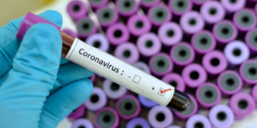 Senegal confirms first coronavirus case