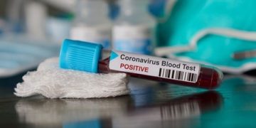 Elections 2020: COVID-19 is a test to political leaders - Senior Research Fellow