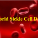 Sickle Cell Foundation of Ghana marks 2020 World Sickle Cell Day with a virtual lecture