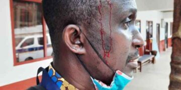 Bright SHS authorities deny knowledge of attack on journalist