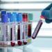 KIA Opening: Noguchi clashes with government over cost of antigen test