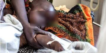 3-yr-old dies after mother fled with donations meant for brain surgery