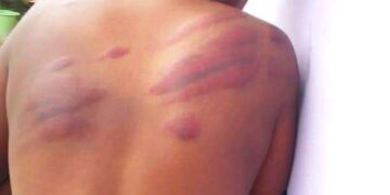 Photos: Headmaster lashes a lady to pulp for helping a colleague