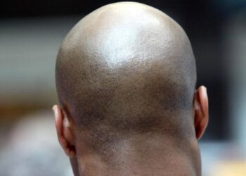 Calling a man ‘bald’ is sexual harassment – Court rules
