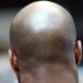 Calling a man ‘bald’ is sexual harassment – Court rules