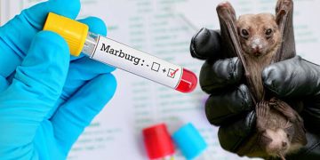 What to know about Marburg virus
