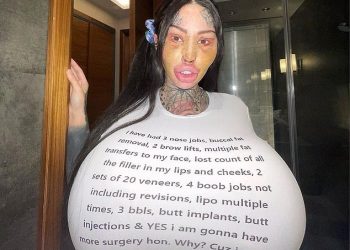 I regret doing plastic surgeries – Model cries