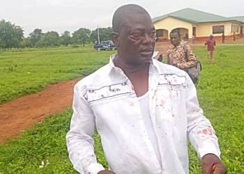 NPP Polls: Campaign coordinator for Alan Kyeremanten assaulted in North East Region