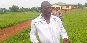 NPP Polls: Campaign coordinator for Alan Kyeremanten assaulted in North East Region