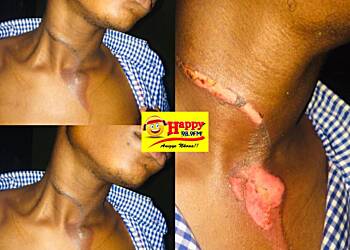 High School Brutalities: Student of Adaklu SHS burnt with hot pressing iron by colleague