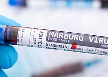 Tanzania confirms Marburg virus outbreak after initial denial