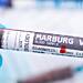 Tanzania confirms Marburg virus outbreak after initial denial