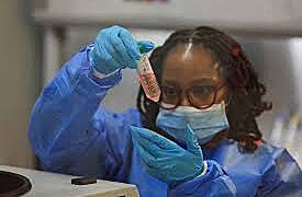 Trump's aid cuts stifle hopes of HIV vaccine in South Africa