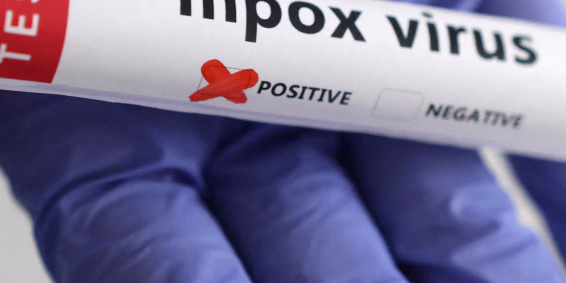 Mpox hits Namibia; first case confirmed