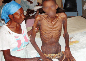 HIV has claimed 44 Million lives globally - WHO warns virus remains major health threat