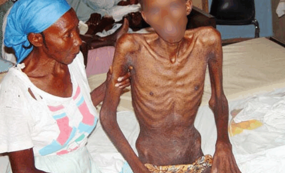 HIV has claimed 44 Million lives globally - WHO warns virus remains major health threat