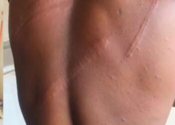 Walewale MP condemns alleged military assault on journalist, civilians