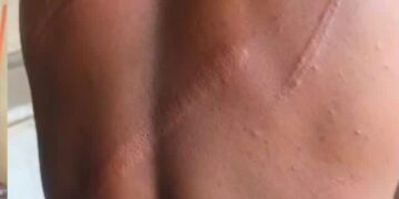 Walewale MP condemns alleged military assault on journalist, civilians