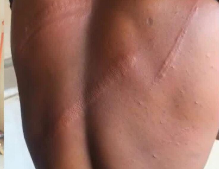 Walewale MP condemns alleged military assault on journalist, civilians