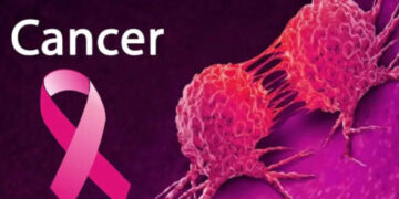 Cancer cases surge in Ashanti region as health authorities urge prevention and early detection